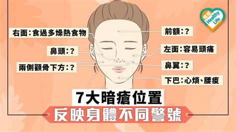 面部生暗瘡|【暗瘡位置】不同代表什麼？中醫教如何處理及預防